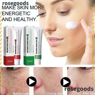 Rosegoods1 พร้อมส่ง ครีมรักษาสิว ไวท์เทนนิ่ง ให้ความชุ่มชื้น ดูแลผิว ลดสิวเสี้ยน สําหรับผู้หญิง