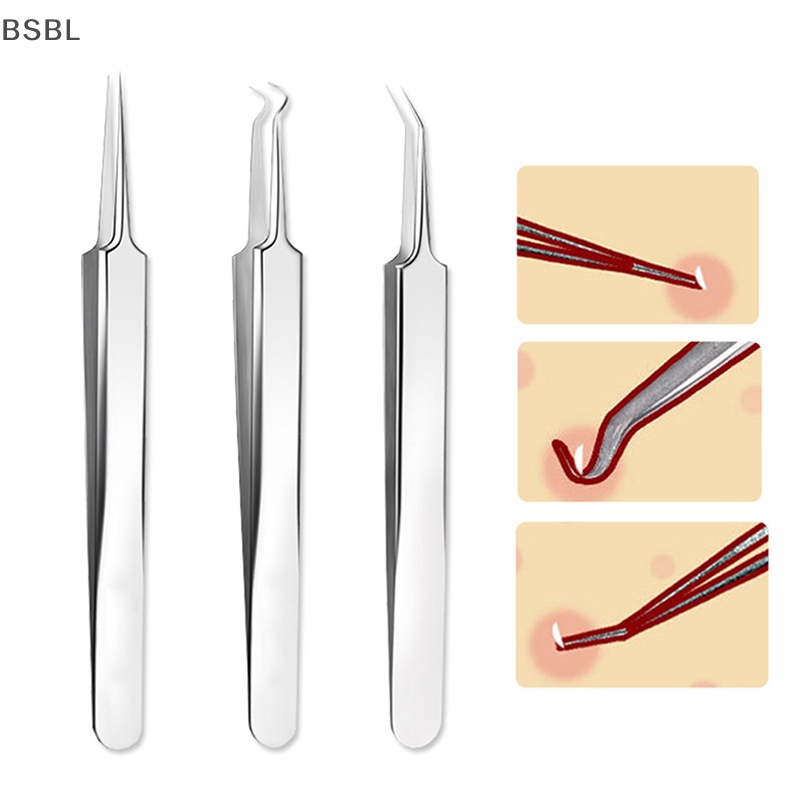 Bsbl แหนบกําจัดสิวเสี้ยน หัวแหลม โค้งงอ เครื่องมือดูแลผิวหน้า BL