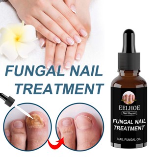 50ml Eelhoe Nail Fungus Treatment Liquid Repair Liquid Nail Repair Serum ขจัดชั้นที่เสียหายของเล็บ, ปฏิบัติต่อเล็บลอกและส่งเสริมการเจริญเติบโตของเล็บที่แข็งแรง puueqg