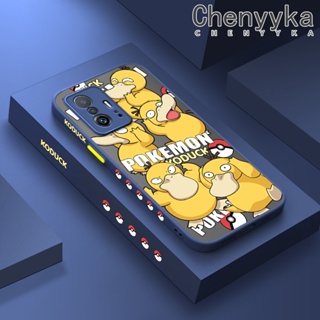 เคสโทรศัพท์มือถือ ซิลิโคนนิ่ม ใส กันกระแทก ลายโปเกม่อน Psyduck แฟชั่น สําหรับ Xiaomi 12T Pro 11T Pro