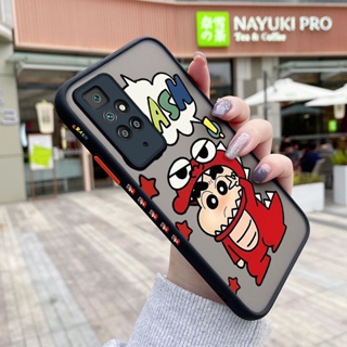 เคสซิลิโคนใส ขอบสี่เหลี่ยม ลายการ์ตูนชินจัง กันกระแทก สําหรับ Xiaomi Redmi 10 5G Redmi 10 Prime Poco X4 NFC