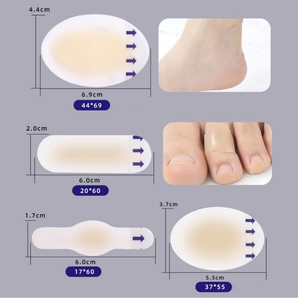 เทปกาวไฮโดรคอลลอยด์ ป้องกันการสึกหรอ สําหรับปฐมพยาบาลฉุกเฉิน