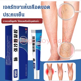 จัดส่งที่รวดเร็ว [ซื้อ 1 ฟรี 1] เจลรักษาเส้นเลือดขอดประคบเย็น 20g