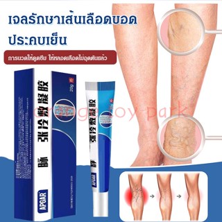 จัดส่งที่รวดเร็ว [ซื้อ 1 ฟรี 1] เจลรักษาเส้นเลือดขอดประคบเย็น 20g