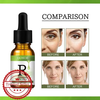 Retinol Essence Original Solution เอสเซ้นบํารุงผิวหน้า ให้ความชุ่มชื้น P2B3