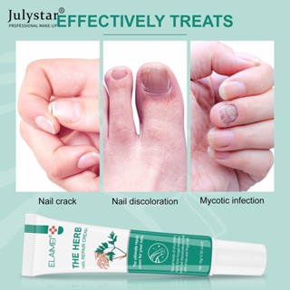 JULYSTAR Nail Onychomycosis Nutrition Cream ครีมบำรุงเล็บมือและเท้าบำรุงเล็บ