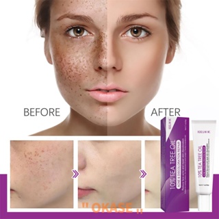 EELHOE Whitening Freckle Cream ครีมทาฝ้า Pekas Remover Dark Spots Remover ปรับผิวกระจ่างใสต่อต้านริ้วรอยพร้อม