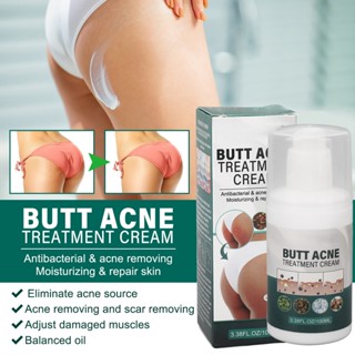 Aday Beauty Butt Pimple Clearing Treatment Balance Oil Moisturizing Skin Repair Pore Cleansing Thigh Area