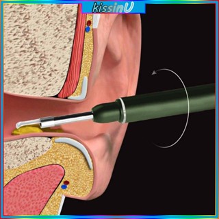 Kiss ชุดทําความสะอาดหู กล้องเอนโดสโคป ขี้หู แบบไร้สาย 3 5 มม. พร้อมไฟ LED สําหรับเด็ก และผู้ใหญ่