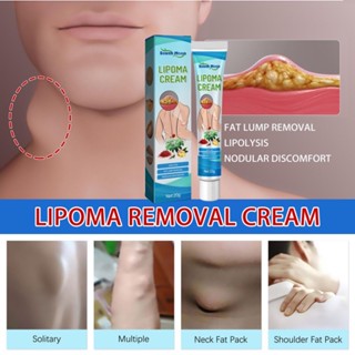 South Moon Lipoma ครีมบํารุงผิวกาย ช่วยบรรเทาอาการปวด