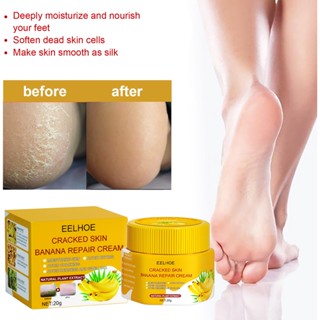 Hot Sale# EELHOE skin cracking banana repair cream foot repair cream maintenance anti-freezing cracking anti-cracking hand and foot care 8ww