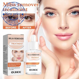 Milia Remover Essence เอสเซ้นส์เม็ดไขมัน บํารุงผิวรอบดวงตา เซรั่มเอสเซ้นบํารุงรอบดวงตา 30 มล. K1P5