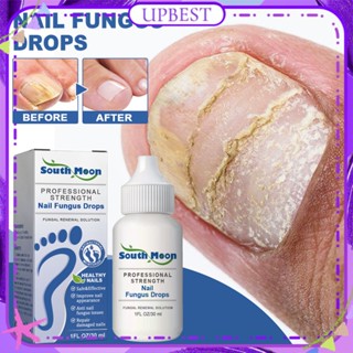 ♕South Moon Nail Fungus Liquid Drops ซ่อม Onychomycosis Hands Feet Rotten Toenail สมุนไพรธรรมชาติ Treatment Nail Care 30Ml Upbest