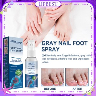 ♕ South Moon Grey Nail Foot Spray Repair Onychomycosis Damaged Skin Anti Fungal Infection Itching Removal Odor Refreshing Care Spray Foot Care 30ml UPBEST