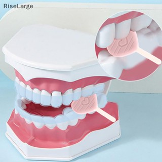 [RiseLarge] ใหม่ ถาดจัดฟันเคี้ยว สําหรับ Aligner Chompers Aligner 2 ชิ้น