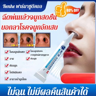 [Ten Years of Rhinitis] Yiyanshu บล็อกเกอร์ บรรเทาอาการแพ้