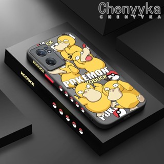 สําหรับ Oneplus Nord CE 2 เคสแฟชั่น Pokemon Psyduck ฝ้าบาง ใส ขอบสี่เหลี่ยม กันกระแทก ซิลิโคน เคสนิ่ม