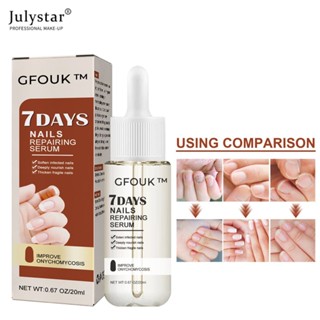 JULYSTAR Cfouk 7 Days Nail Repair Essence มือเท้า Onychomycosis Rotten Toenail Soft Nail Thickeningtreatment Moisturizing Care Essence Body Care 20ml 1pc