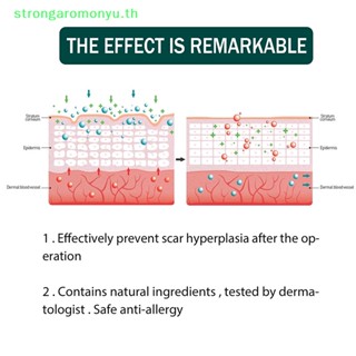 Strongaromonyu แผ่นซิลิโคน กันน้ํา สําหรับซ่อมแซมรอยแผลเป็น รอยแผลเป็น