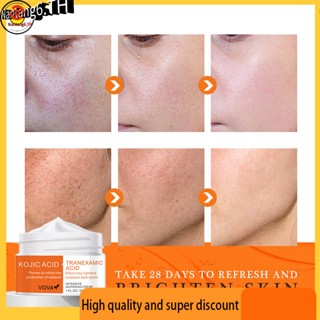 Kojic Acid Tranexamic Acid Dark Spot Corrector ครีมไวท์เทนนิ่ง ลดฝ้า กระ จุดด่างดํา กระ กระ จุดด่างดํา 30 มล.