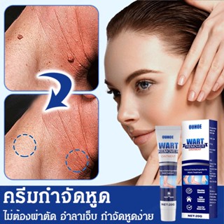 🚀[พร้อมสต็อก] 【ซื้อ 1 ฟรี 2】ครีมกำจัดหูดซ่อมแซมร่างกาย ครีมกำจัดหูดทำความสะอาดผิว