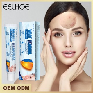 Tiktok same style# eelhoe verruca cream hand and foot face underarm flesh neck filamentous excellent plantar excellent sharp ointment 8.6N