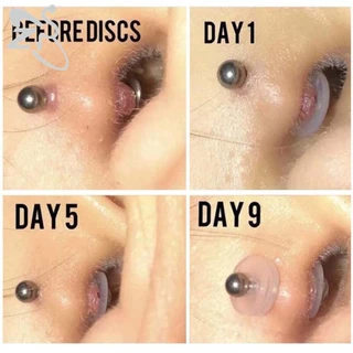 Bodyace แผ่นซิลิโคนเจาะร่างกาย ยืดหยุ่น ป้องกัน Hyperplasia สําหรับยึดลิ้น ต่างหู กระดูกอ่อน 10-200 ชิ้น