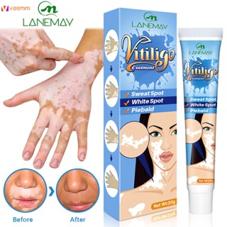 Lanemay White Spot Cream Sweat Spot White Spot Skin Topical Cream Spot Care Repair Cream veemm