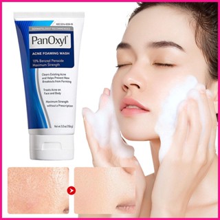 คลีนเซอร์โฟมทําความสะอาดผิวหน้า กําจัดสิวเสี้ยน สิวหัวดํา 10 Benzoyl Peroxide ควบคุมความชุ่มชื้น อ่อนโยน ซ่อมแซมผิวหน้า