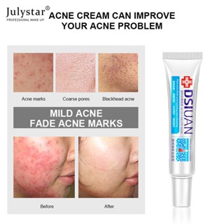 JULYSTAR Bai Zhen Tang Skin Research ครีมไวท์เทนนิ่งมอยซ์เจอไรเซอร์รูขุมขนหดตัว Fade Spots Freckle Cream Acne Cream