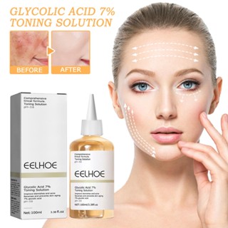 Glycolic Acid โทนเนอร์ 7% กําจัดรอยปากปิด