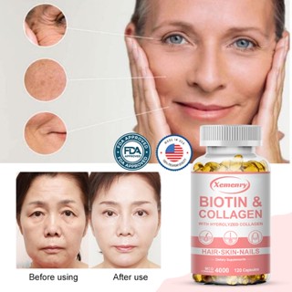 Biotin Collagen Capsules 4000 mcg - ผม ผิว เล็บ กระดูก ข้อต่อ วิตามิน