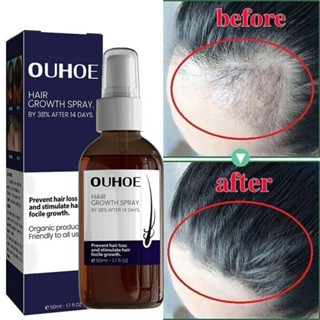  OUHOE hair growth spray strengthens hair roots to prevent hair loss 50ml