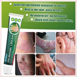 Sumifun Psoriasis Cream Repair Inching Inflammation Redness Swelling Anti Bacterial Eczema Treatment สมุนไพรธรรมชาติ Oinment Body Care 1Pc ผลิตภัณฑ์20G JOYFEEL