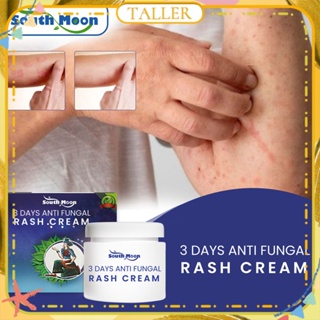 ✧Ready Stcok South Moon 3 Days Anti Fungal Rash Cream Antibacterialบรรเทาอาการคัน บวม กลาก Psoriasis Treatment Ointment Body Care TALLER