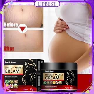 ♕ South Moon Dilute Stretch Marks Cream Repair Growth Lines Anti-wrinkle Improved Sagging Dullness Moisturizing Whitening Skin Ointment Body Care UPBEST