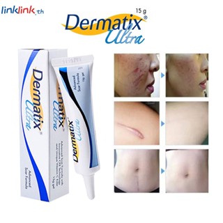 2 ชิ้น Dermatix Ultra Acne Scar Advance Gel Formula 15g Linklink