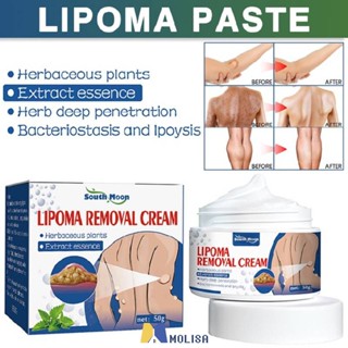 1/3/5pcs South Moon ครีมกำจัด Lipoma สำหรับมนุษย์ Lipoma ก้อนครีมกำจัดหยุดก้อนไขมันกำจัดไขมันของคุณ MOLISA MOLISA