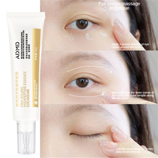 【COD】Admd 30g Polypeptide Eye Cream Anti Dark Circles And Eye Bags In The Eyes Anti Aging Contour Corrector Puffy Eye Wrinkls Removal Creme Eye Skin Care Produits