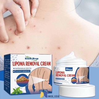 South Moon Lipoma Ointment Lipoma ครีมกำจัด Lipoma ครีมสลายไขมันครีมกำจัดไขมัน 5pcs * 50g MOLISA MOLISA