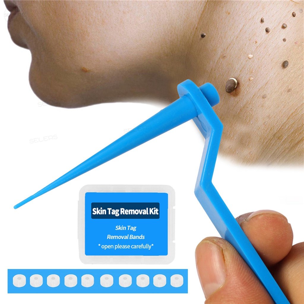 Skin Tag Remover Band Warts Removal Rubber Band Mole Kulugo Remover Kit พร้อมแผ่นทําความสะอาด