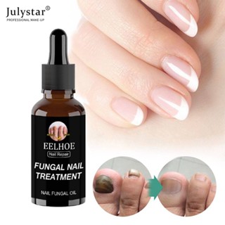 JULYSTAR Eelhoe Nail Fungus Treatment Liquid Refreshing ไม่เหนียวเหนอะหนะติดทนนานสูงสุด Strength Anti Fungus Anti-fungal Treatment Repair Liquid For Men Women Care