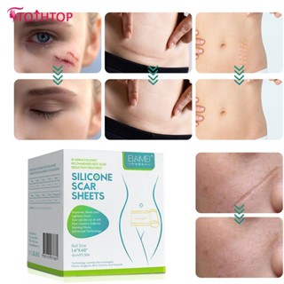 Elaimei Small Scar Roll Self-adhesive Scar Removal Sticker Stretch Marks Scald Caesarean Section Scar Sticker [TOP]