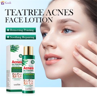 Sadoer Anti-acne Skin Care Products Tea Tree Anti-acne Oil Control Lotion 【goob】