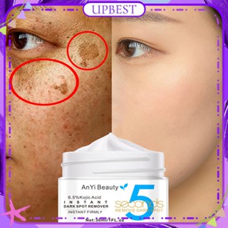 ♕Anyi Beauty Kojic Acid Instant Dark Spot Remover ครีม Whitening Removal Freckle Chloasma สิวจุด Pigment Anti Wrinkle Moisturizing ครีม Face Care 30Ml UPBEST