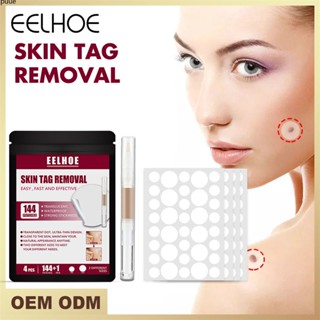 ชุดกำจัดหูด Eelhoe Wart Treatment Patch การดูแลผิวชุดแพทย์ Anti-wart Antibacterial Patch puueqg