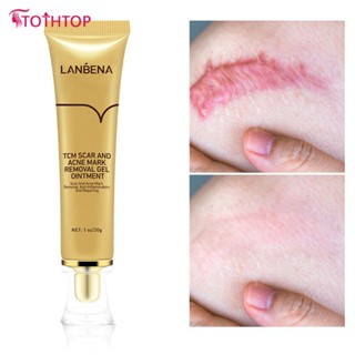 Lanbena Scar Remover Cream Repair Serum Stretch Mark Blackhead Acne Spots Tcm Removal Gel Whitening Face Body Essence Stretchmark Skincare 30g [TOP]