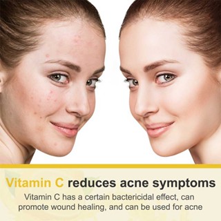 Vitamin C Cream Anti-aging Facial Hyaluronic Acid Retinol Wrinkle Moisturizer