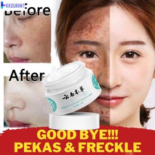 3 ชิ้นที่มีประสิทธิภาพ Pekas Remover Blemishs Cream, Face Cream, Dark Spots, Blends, Whitening KDURANT