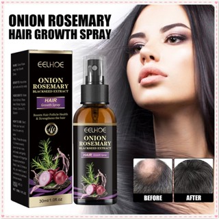 Eelhoe Onion Rosemary Hair Growth Spray ป้องกันผมร่วง ส่งเสริมการเจริญเติบโตของเส้นผม เพิ่มความเงางามของเส้นผม สเปรย์ Essence Anti-falling Essence บำรุงผม JOYFEEL